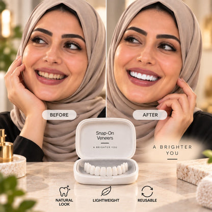 Snap-On Veneers — Your Smile, Your Confidence (Pack of Two Veneers)
